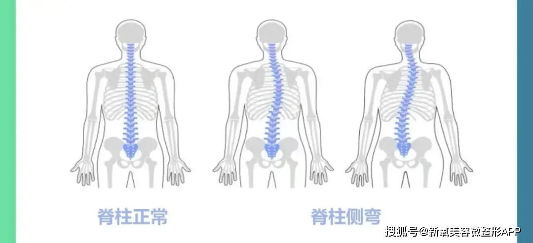 ab复出试水失败返港发展？！穿迷你裙扭腰摆拍，被嘲重回嫩模时代__ab复出试水失败返港发展？！穿迷你裙扭腰摆拍，被嘲重回嫩模时代